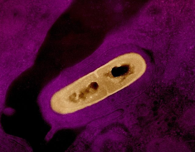 La bactérie Listeria vue au microscope La bactérie Listeria vue au microscope