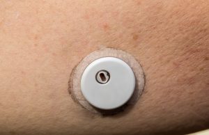 Capteur FreeStyle Libre : Abbott demande de mettre à jour l’application, qui pourrait afficher une glycémie erronée ou rester muette Un capteur de glucose FreeStyle Libre 3 posé sur le bras (photo d'illustration)